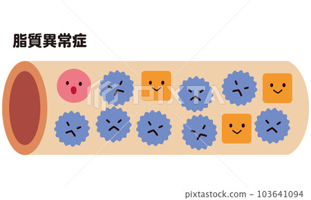 Blood vessels in normal condition and blood vessels with dyslipidemia Cholesterol 103641094