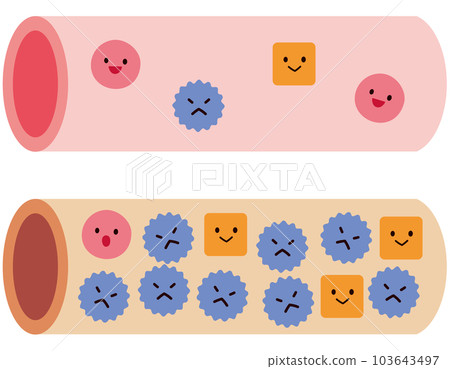 Blood vessels in normal condition and blood vessels with dyslipidemia Cholesterol 103643497
