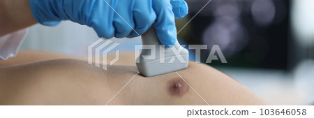 Doctor conducts ultrasound examination of patient heart 103646058