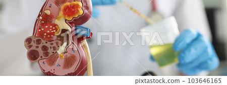 Doctor makes an express urine test using indicator paper in clinic closeup 103646165