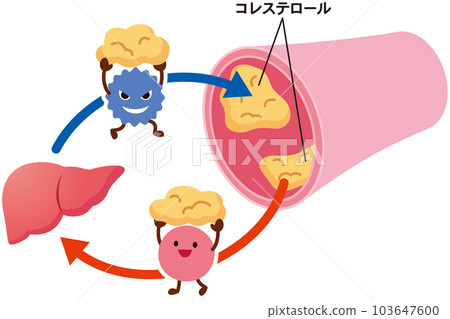 Mechanism of LDL and HDL Dyslipidemia Blood vessels Cholesterol 103647600