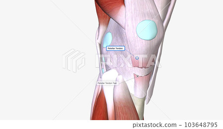 When a tendon is weakened by age or overuse, trauma can cause it to rupture. 103648795