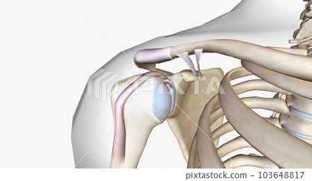 A superior labral tear is when a lesion is found in the upper portion for the labrum. 103648817