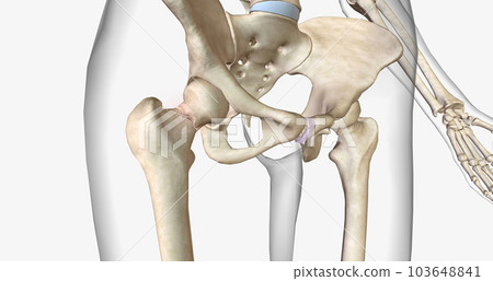 A femoral neck fracture is a type of hip fracture that occurs in the section of the femur closest to the pelvis. A femoral neck fracture is a type of hip fracture that occurs in the section of the femur closest to the pelvis. 103648841