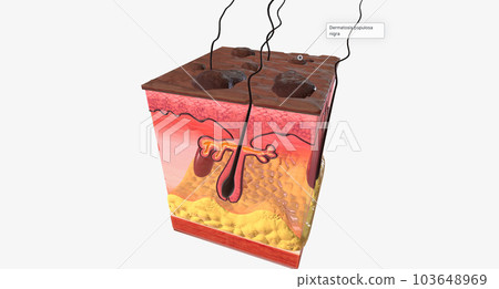 The DPN in Skin Tissue The DPN in Skin Tissue 103648969