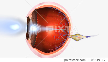 Hyperopia is a common visual condition in which the eye's ability to focus on nearby objects is impaired. 103649117