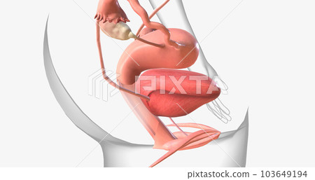 Gonorrhea is a sexually transmitted infection caused by the bacterium Neisseria gonorrhoeae Gonorrhea is a sexually transmitted infection caused by the bacterium Neisseria gonorrhoeae 103649194