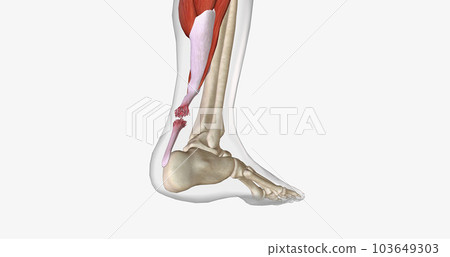 Flexion and Extension with Torn Achilles Tendon 103649303
