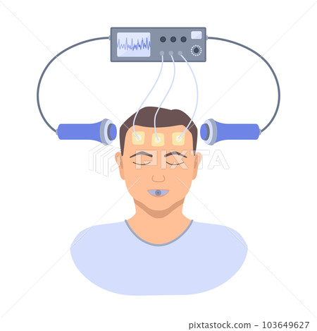 ECT electroconvulsive therapy for severe depression treatment 103649627