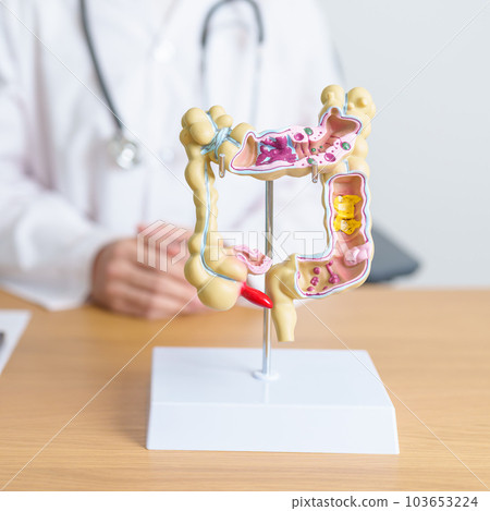 Doctor with human Colon anatomy model. Colonic disease, Large Intestine, Colorectal cancer, Ulcerative colitis, Diverticulitis, Irritable bowel syndrome, Digestive system and Health concept 103653224