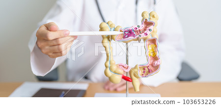 Doctor with human Colon anatomy model. Colonic disease, Large Intestine, Colorectal cancer, Ulcerative colitis, Diverticulitis, Irritable bowel syndrome, Digestive system and Health concept Doctor with human Colon anatomy model. Colonic disease, Large Intestine, Colorectal cancer, Ulcerative colitis, Diverticulitis, Irritable bowel syndrome, Digestive system and Health concept 103653226