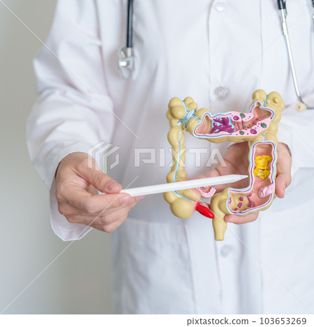 Doctor holding human Colon anatomy model. Colonic disease, Large Intestine, Colorectal cancer, Ulcerative colitis, Diverticulitis, Irritable bowel syndrome, Digestive system and Health concept 103653269
