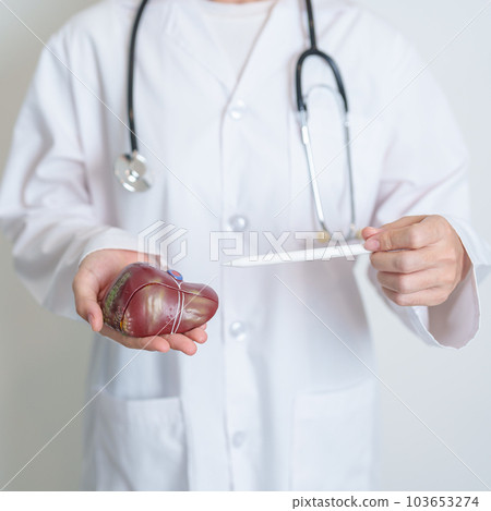 Doctor holding human Liver anatomy model. Liver cancer and Tumor, Jaundice, Viral Hepatitis A, B, C, D, E, Cirrhosis, Failure, Enlarged, Hepatic Encephalopathy, Ascites Fluid in Belly and health Doctor holding human Liver anatomy model. Liver cancer and Tumor, Jaundice, Viral Hepatitis A, B, C, D, E, Cirrhosis, Failure, Enlarged, Hepatic Encephalopathy, Ascites Fluid in Belly and health 103653274