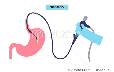 Gastroscopy endoscopy procedure 103656939