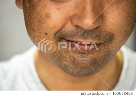 低頭和咧嘴笑的噁心的中年人 103658496