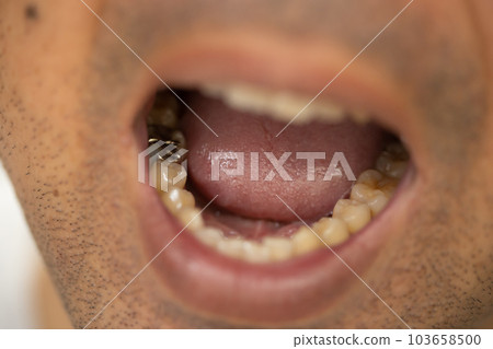 張嘴露出牙齒的男人 銀牙 103658500
