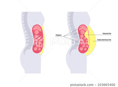 Visceral fat diagram 103665400
