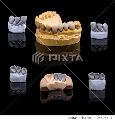 Artificial tooth Artificial tooth 103695505