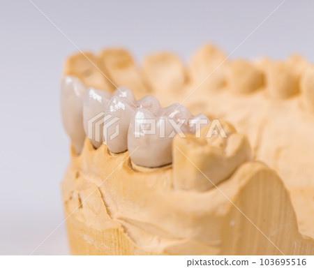Denture made of ceramics Denture made of ceramics 103695516