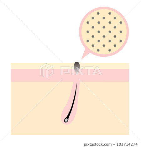 Skin with dark spots. Image of skin trouble. 103714274