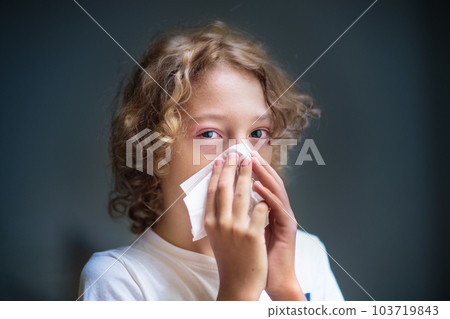 Child with swollen pink eye. Eyes infection. Child with swollen pink eye. Eyes infection. 103719843