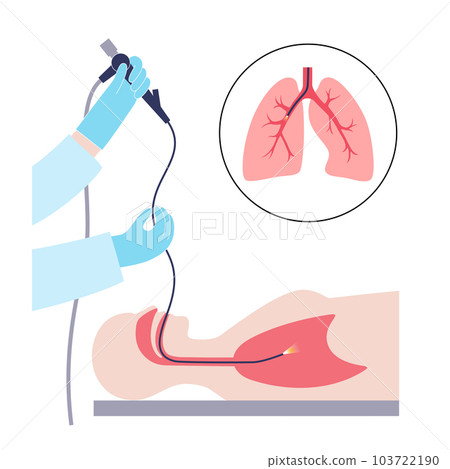 Bronchoscopy procedure concept 103722190