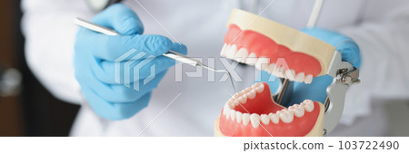 Dentist shows problem areas in teeth on jaw model 103722490