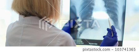 Doctor pulmonologist examining x-ray photograph of lungs 103741365