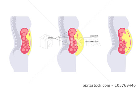Visceral fat diagram 103769446