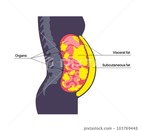 Visceral fat diagram 103769448