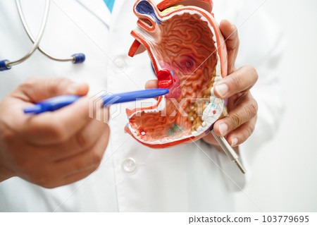 Stomach disease, doctor holding anatomy model for study diagnosis and treatment in hospital. 103779695