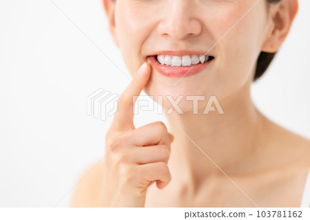 Beauty Dental Teeth Whitening Beauty Dental Teeth Whitening 103781162