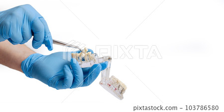 Dental technician working on a dental prosthetic in a dental laboratory Dental technician working on a dental prosthetic in a dental laboratory 103786580