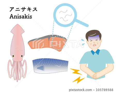 異尖線蟲(寄生蟲)引起的食物中毒插圖集 異尖線蟲(寄生蟲)引起的食物中毒插圖集 103789388