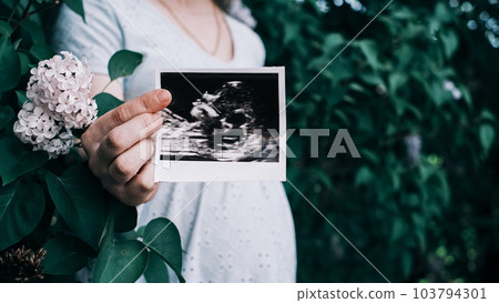 Close-up of a pregnant girl in a soft blue dress with a photo of an ultrasound examination of a child in the garden 103794301