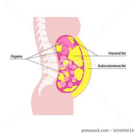 Visceral fat diagram 103809218