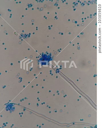 blue mold spores blue mold spores 103859810