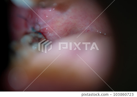 mouth, oral, mouths 103860723