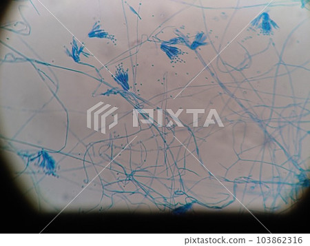 Mold spores found in refrigerator Mold spores found in refrigerator 103862316