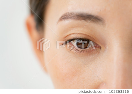 中年女人眼睛周圍 中年女人眼睛周圍 103863316