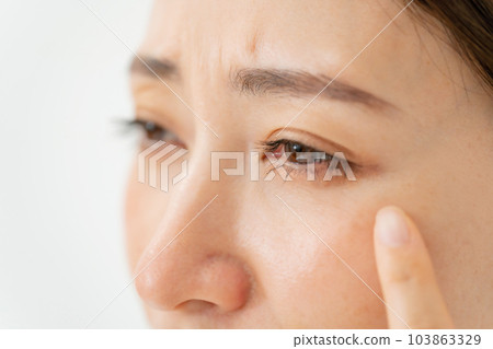 Middle-aged woman around the eyes 103863329