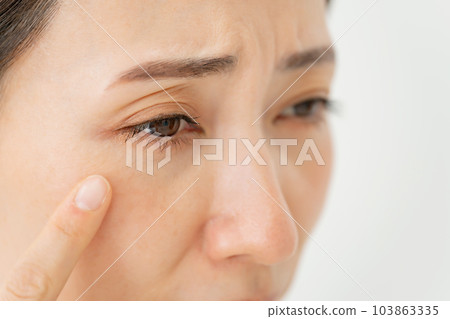 Middle-aged woman around the eyes 103863335
