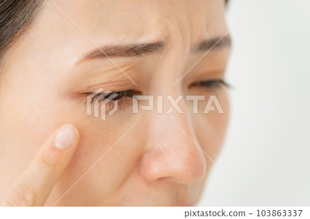 Middle-aged woman around the eyes 103863337