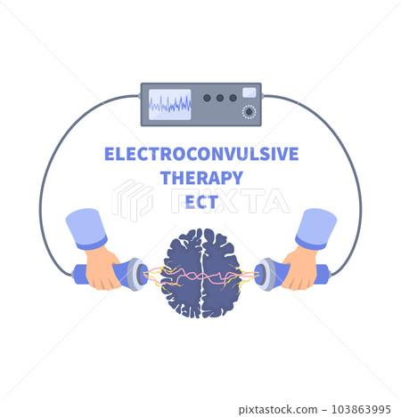 ECT electroconvulsive therapy for severe depression treatment 103863995