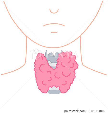 Enlarged thyroid gland on neck silhouette diagram 103864000