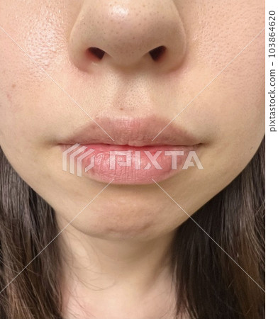 Mouth area pore image Mouth area pore image 103864620