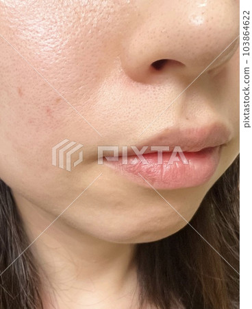 Mouth area pore image Mouth area pore image 103864622