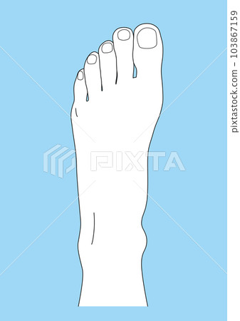 人體部位腳背腳線畫皮釘一條腿背景藍色 103867159
