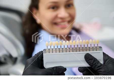 Selective focus on tooth color chart in the gloved hands of a doctor dentist, choosing the shade of veneers, according to Vita scale. Blurred smiling female patient at dental appointment in background 103870196