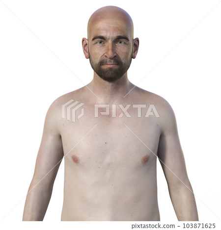 A 3D photorealistic illustration showcasing the upper half part of a man with a beard, devoid of hair, revealing his skin and facial features A 3D photorealistic illustration showcasing the upper half part of a man with a beard, devoid of hair, revealing his skin and facial features 103871625